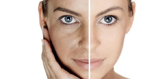 pred in po pomlajevanju kože obraza