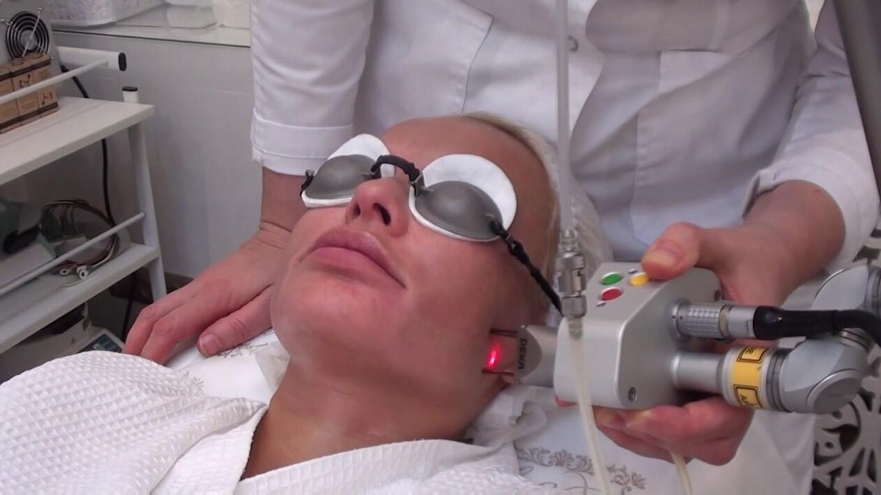 Zdravljenje z laserskim žarkom problematičnih predelov kože obraza
