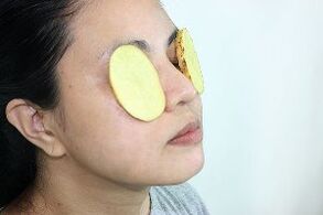 uporaba krompirja za pomlajevanje okrog oči