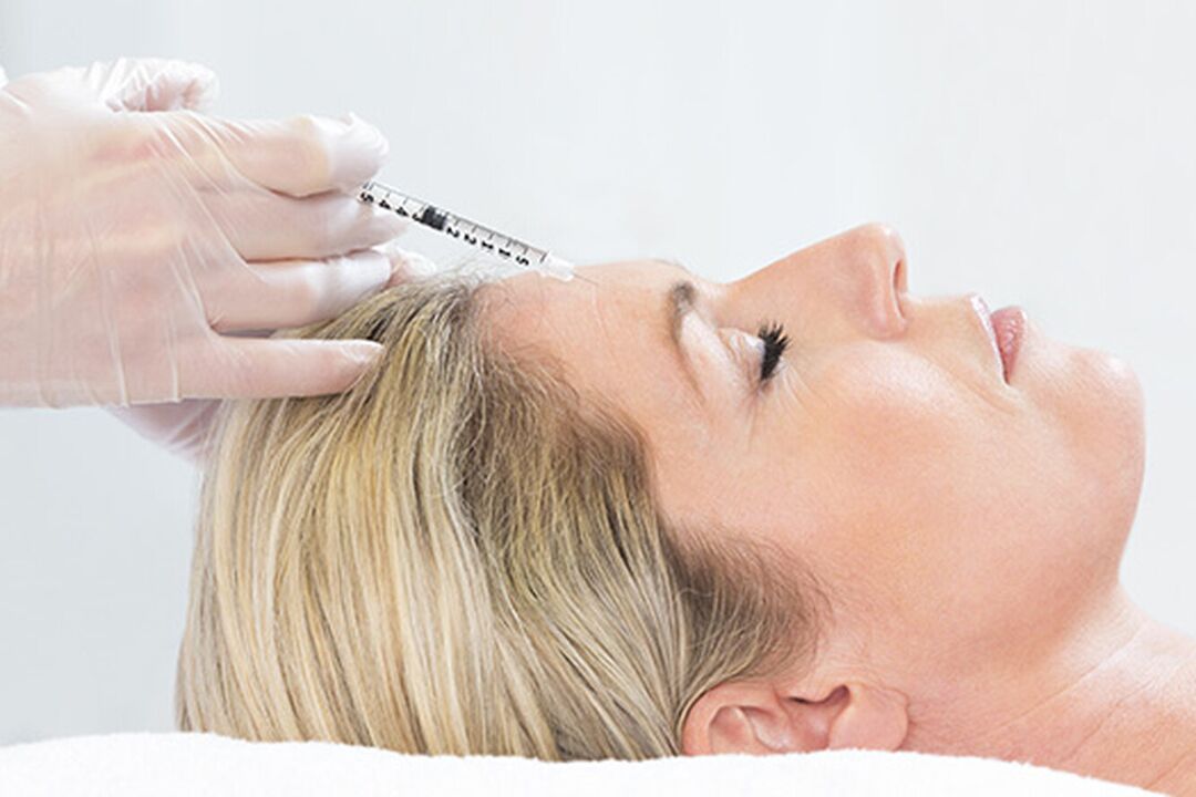 Plazmolifting je injekcijska metoda pomlajevanja kože obraza